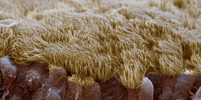 Фаготерапія синуситу: дослідження in vivo